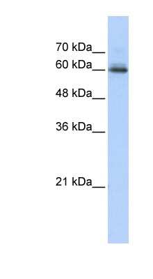 Western Blot: Semaphorin 4F Antibody [NBP1-59942]