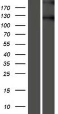 Western Blot: Semaphorin 5B Overexpression Lysate [NBP2-08589]