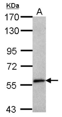 Western Blot: Semaphorin 6C Antibody [NBP2-15114]