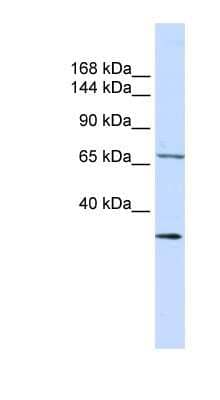 Western Blot: Semaphorin 6D Antibody [NBP1-62240]