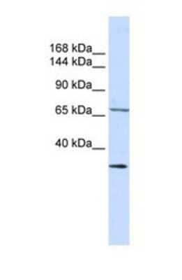 Western Blot: Semaphorin 6D Antibody [NBP1-69274]