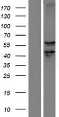 Western Blot: Semaphorin 6D Overexpression Lysate [NBP2-06257]