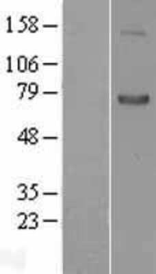 Western Blot: Semaphorin 7A Overexpression Lysate [NBL1-15805]