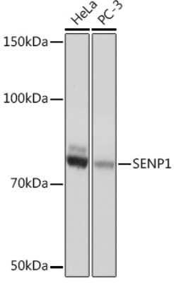 Western Blot: SENP1 Antibody (1C3I4) [NBP3-16417]