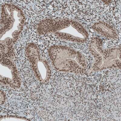 Immunohistochemistry-Paraffin: SENP1 Antibody [NBP1-89553]