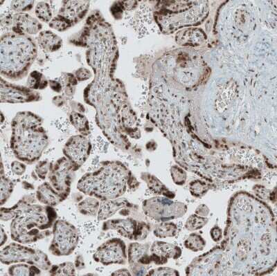 Immunohistochemistry-Paraffin: SENP1 Antibody [NBP1-89553]