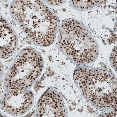 Immunohistochemistry-Paraffin: SENP1 Antibody [NBP1-89553]