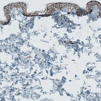 Immunohistochemistry-Paraffin: SENP1 Antibody [NBP1-89553]