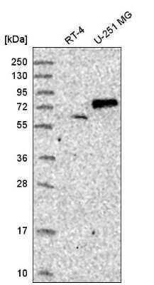 Western Blot: SENP1 Antibody [NBP2-55420]