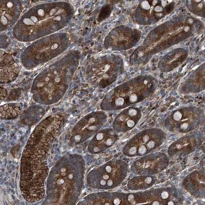 Immunohistochemistry-Paraffin: SENP2 Antibody [NBP1-88919]