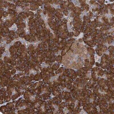 Immunohistochemistry-Paraffin: SENP2 Antibody [NBP1-88920]