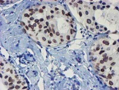 Immunohistochemistry: SENP2 Antibody (OTI3D3) - Azide and BSA Free [NBP2-74062]