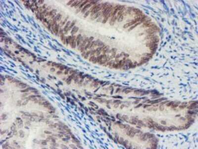 Immunohistochemistry: SENP2 Antibody (OTI3D3) - Azide and BSA Free [NBP2-74062]