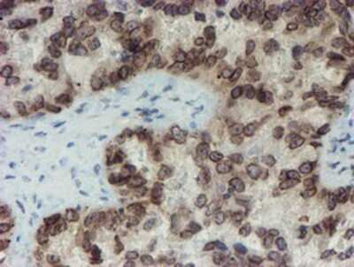 Immunohistochemistry: SENP2 Antibody (OTI3D3) - Azide and BSA Free [NBP2-74062]