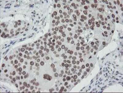 Immunohistochemistry: SENP2 Antibody (OTI3D3) - Azide and BSA Free [NBP2-74062]