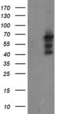 Western Blot: SENP2 Antibody (OTI3D3)Azide and BSA Free [NBP2-74062]