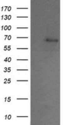 Western Blot: SENP2 Antibody (OTI4B3)Azide and BSA Free [NBP2-74060]