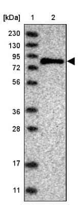 Western Blot: SENP2 Antibody [NBP1-88919]