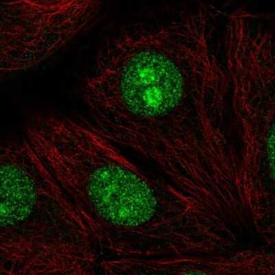 Immunocytochemistry/ Immunofluorescence: SENP3 Antibody [NBP2-32525]