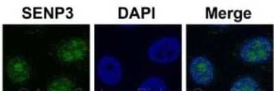 Immunohistochemistry: SENP3 Antibody [NBP1-56590]