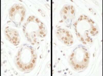 Immunohistochemistry: SENP3 Antibody [NBP1-71894]
