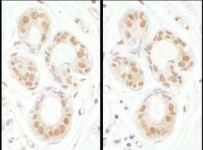 Immunohistochemistry: SENP3 Antibody [NBP1-71895]