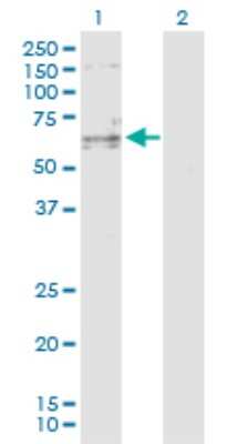 Western Blot: SENP3 Antibody [H00026168-D01P]