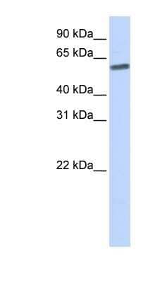 Western Blot: SENP3 Antibody [NBP1-56590]