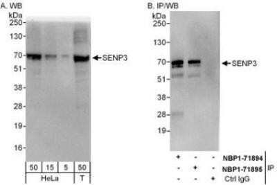 Western Blot: SENP3 Antibody [NBP1-71895]