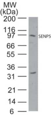 Western Blot: SENP5 Antibody [NB100-56412]