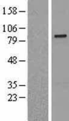 Western Blot: SENP5 Overexpression Lysate [NBL1-15811]