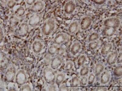 Immunohistochemistry-Paraffin: SENP6 Antibody (4B7) [H00026054-M01]