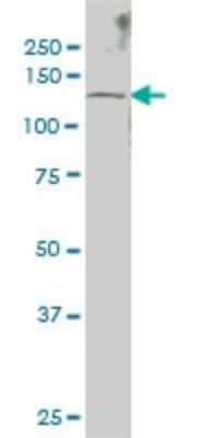 Western Blot: SENP6 Antibody (4B7) [H00026054-M01]