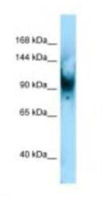 Western Blot: SENP6 Antibody [NBP1-98428]