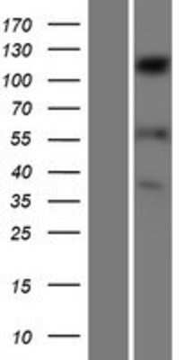 Western Blot: SENP6 Overexpression Lysate [NBP2-07141]