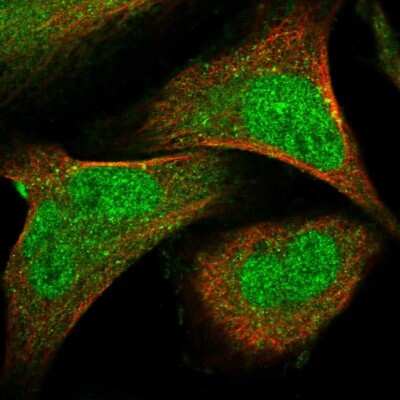 Immunocytochemistry/ Immunofluorescence: SENP7 Antibody [NBP1-86394]