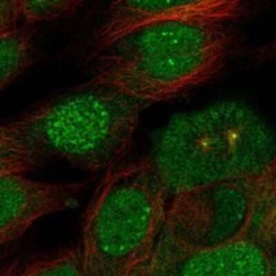 Immunocytochemistry/ Immunofluorescence: SENP7 Antibody [NBP3-17929]