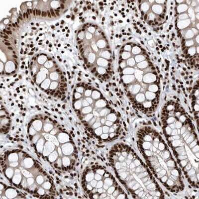 Immunohistochemistry-Paraffin: SENP7 Antibody [NBP1-86394]