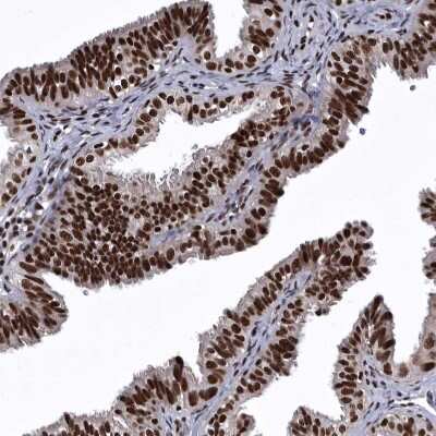 Immunohistochemistry-Paraffin: SENP7 Antibody [NBP1-86394]