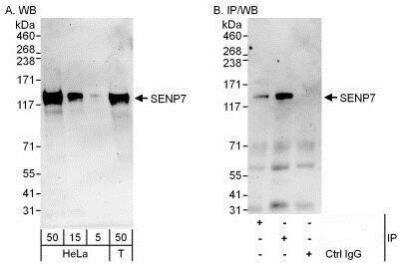 Western Blot: SENP7 Antibody [NBP1-50027]