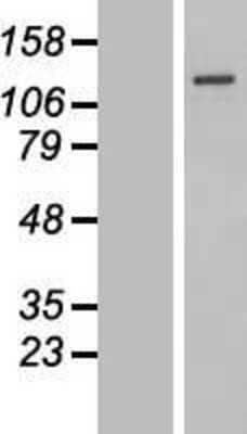 Western Blot: SENP7 Overexpression Lysate [NBP2-06609]