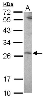 Western Blot: NEDP1/SENP8 Antibody [NBP2-20296]