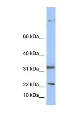 Western Blot: SEP15 Antibody [NBP1-91629]