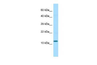 Western Blot: SEP15 Antibody [NBP3-09259]