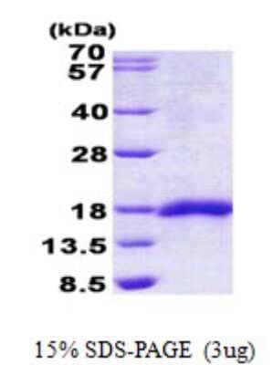 SDS-PAGE: Recombinant Human SEP15 His Protein [NBP2-22642]