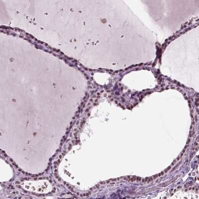 Immunocytochemistry/ Immunofluorescence: SEPHS1 Antibody [NBP2-68784]