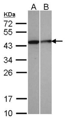 Western Blot: SEPHS1 Antibody [NBP1-32312]