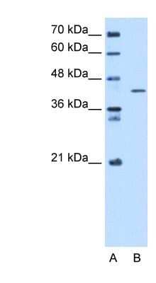 Western Blot: SEPHS1 Antibody [NBP1-55167]