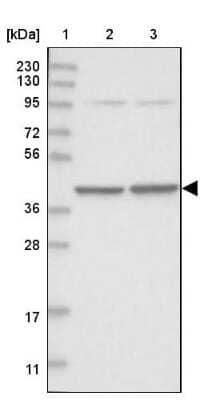 Western Blot: SEPHS1 Antibody [NBP1-87008]