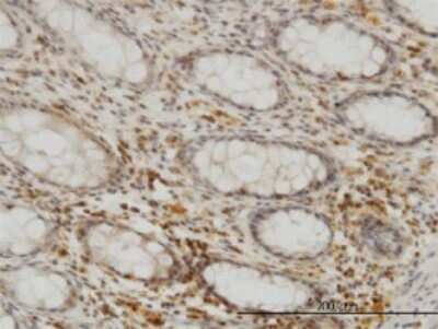 Immunohistochemistry-Paraffin: SEPHS2 Antibody (2G9) [H00022928-M02]